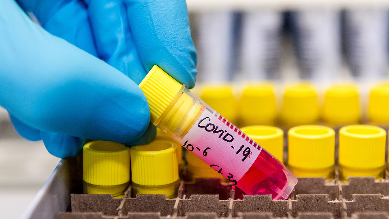 Virology Lab Work As Europe On Coronavirus High Alert