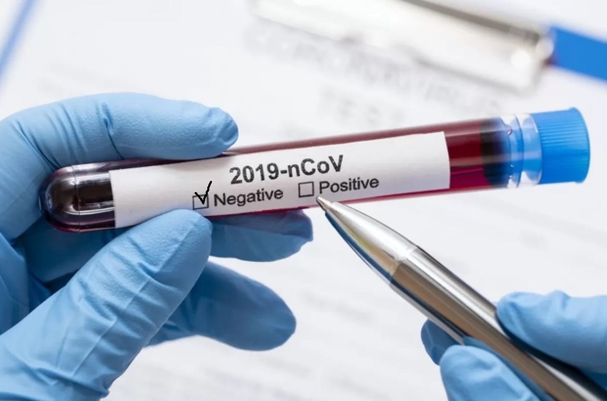 7-koronavirus-test-nehatyvnyj