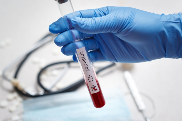 blood-test-tube-doctor-hand-mers-cov-coronavirus-test-positive-label-hospital-blood-test-tube-analysis-2019-ncov-virus-infection-originating-wuhan-china_159057-636