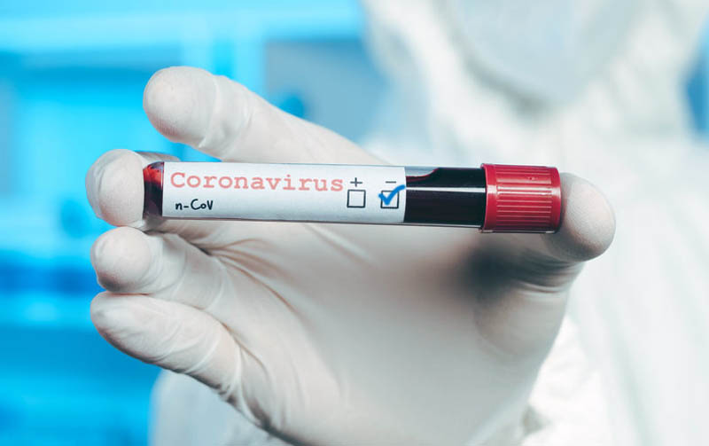 Koronavirus Otriczatelnyj